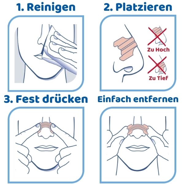 50% Nasenpflaster Nasenklammern elitesportique   